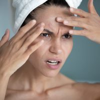 اثرات استرس روی پوست و مو | پیشگیری و درمان